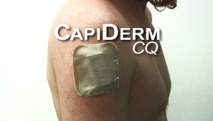 Capiderm
